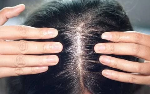 jojoba yagi saca nasil uygulanir ve jojoba yaginin saca faydalari nelerdir 1