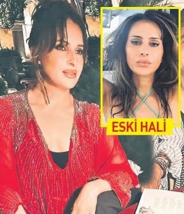 ali koc un esi nevbahar koc un estetik faciasi 6