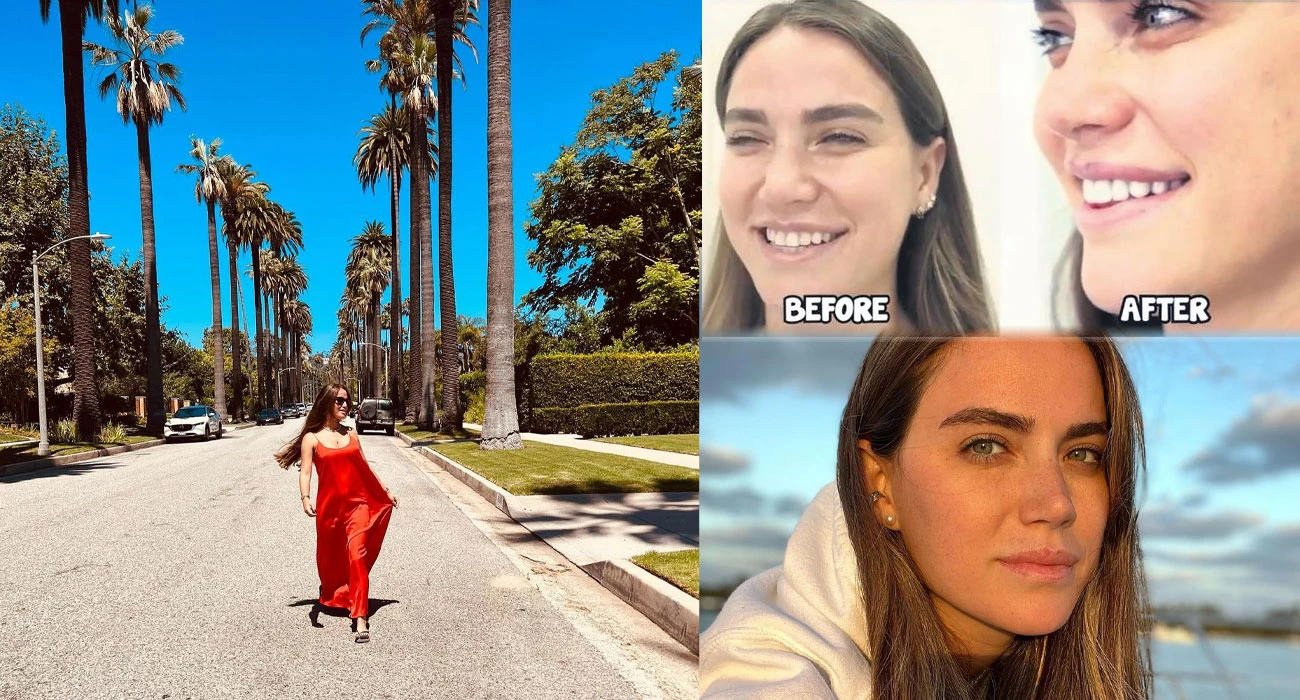 ceyda ates acikladi doktor icin turkiye ye geliyoru 2