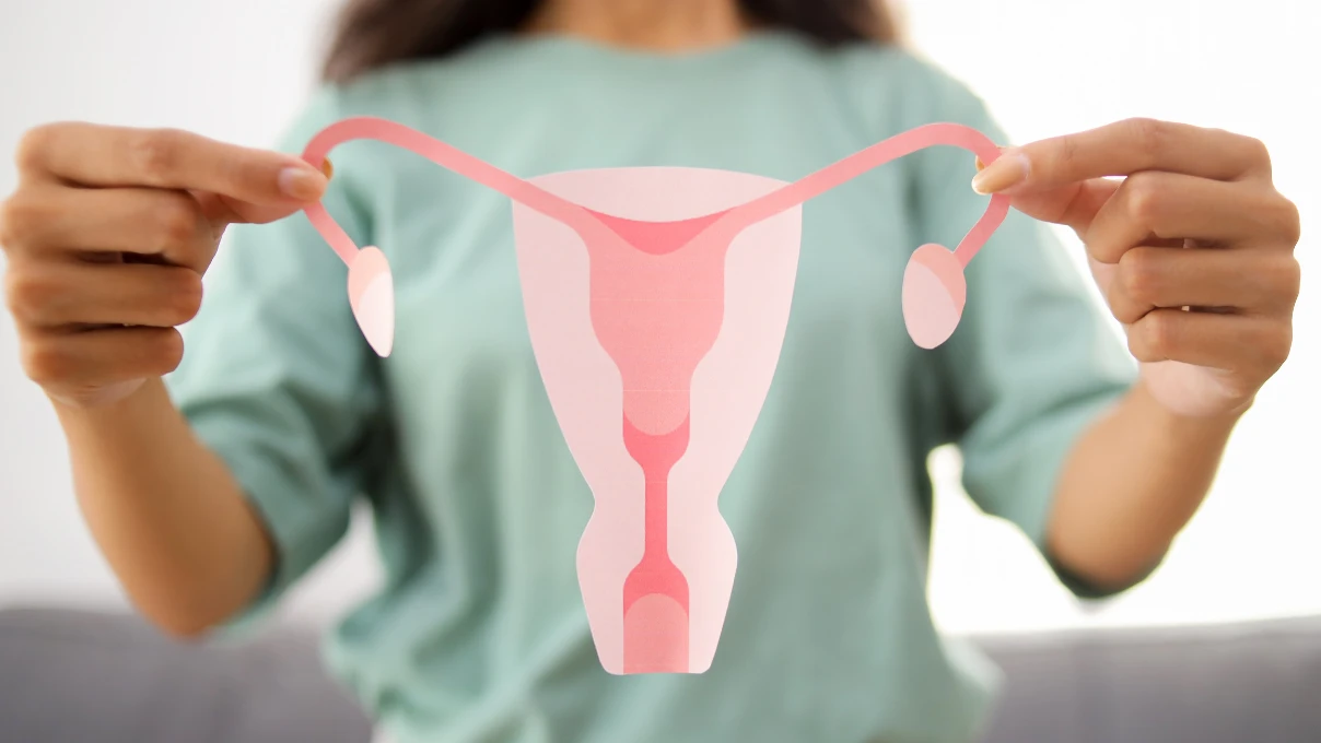 Polikistik Over Sendromu 1