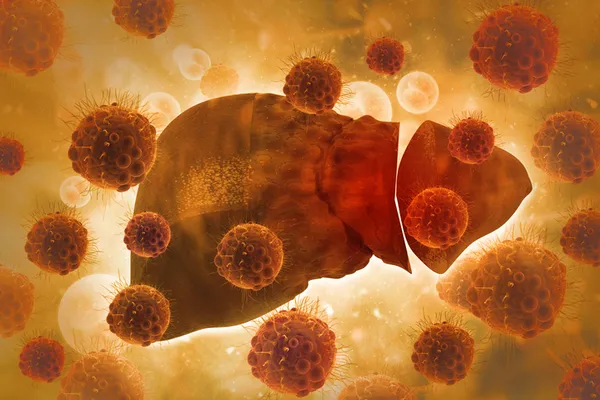 0x0 her 3 kisiden birinde bu hastalik goruluyor 1625214066865