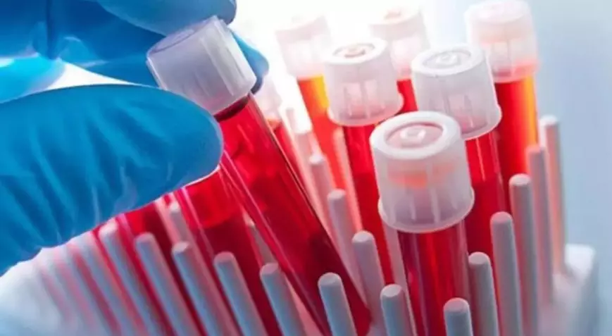 5ffada2e55427f012437952e