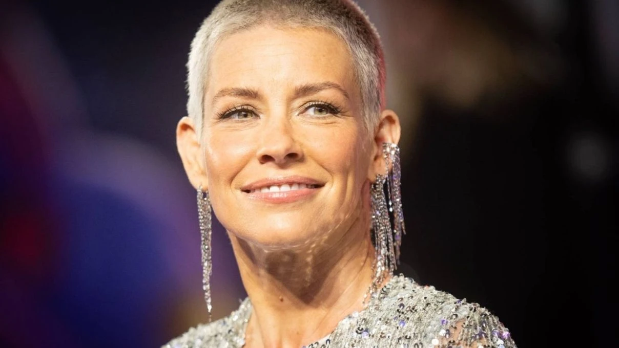 Evangeline Lilly’den kötü haber! Geçirdiği kaza sonrası beyninde hasar oluştu 5 Evangeline Lilly’den kötü haber! Geçirdiği kaza sonrası beyninde hasar oluştu