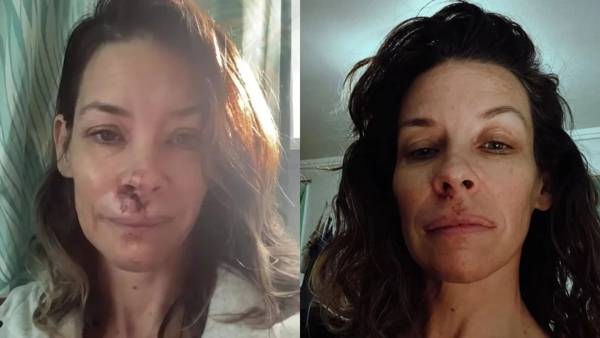 Evangeline Lilly’den kötü haber! Geçirdiği kaza sonrası beyninde hasar oluştu 8 Evangeline Lilly’den kötü haber! Geçirdiği kaza sonrası beyninde hasar oluştu