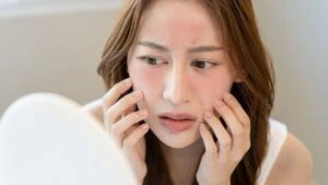 Kızarık ve hassas ciltli olanlar aman dikkat!