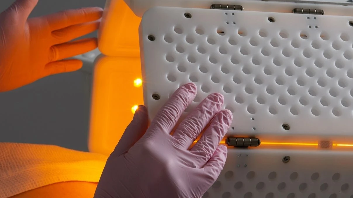 Fotodinamik tedavi acıtıyor mu? Fotodinamik tedavi akne ve lekelere iyi gelir mi?