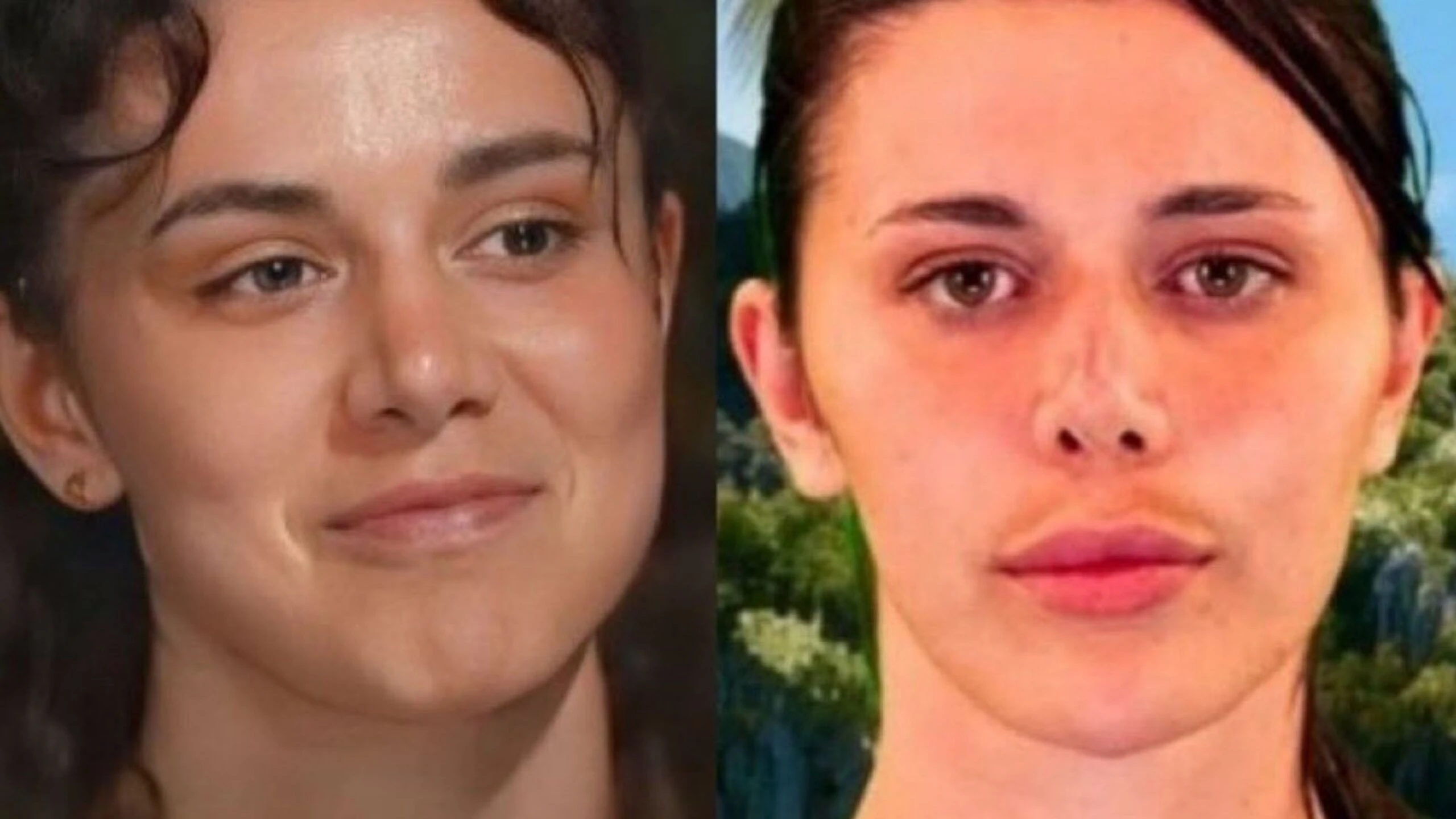 Survivor 2026 Nefise Karatay'dan estetik itirafı! Yüzüm bana ait değil 7 Adsiz tasarim 6 16 scaled