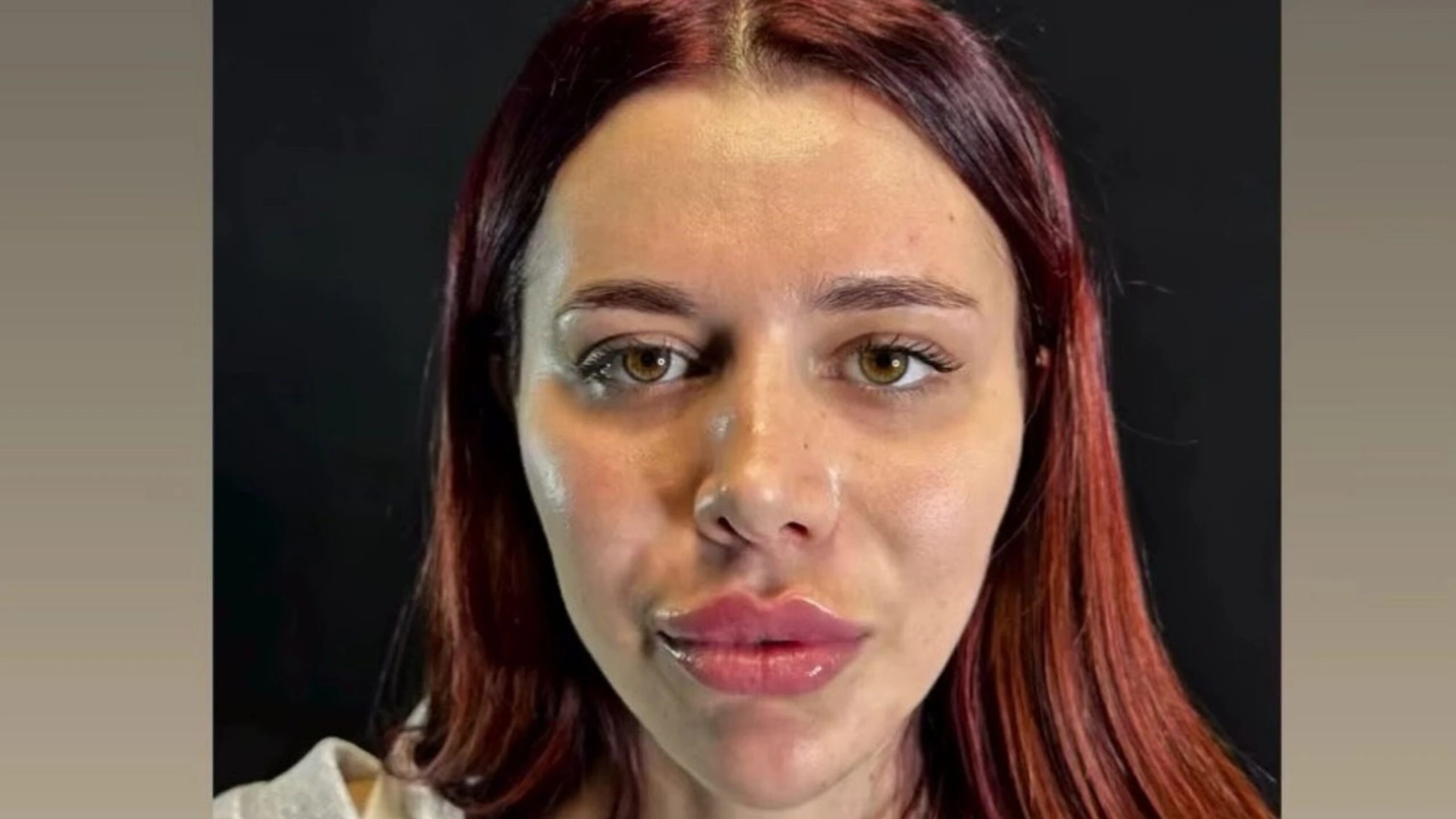 Survivor 2026 Nefise Karatay'dan estetik itirafı! Yüzüm bana ait değil 5 Adsiz tasarim 9 9 scaled