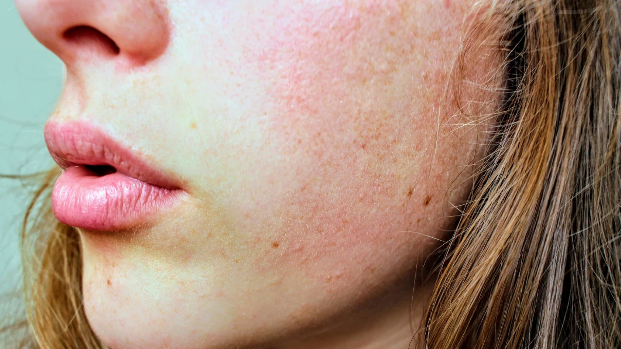 Asli 2026 01 07T155354.480