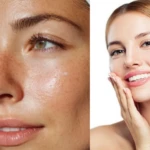 kuru cilt nasıl nemlendirilir? kuru cilt için nemlendirici