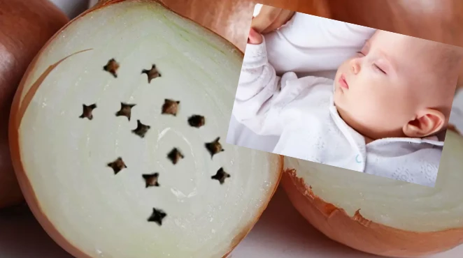 Bebeklerde burun tıkanıklığı için soğan karanfil