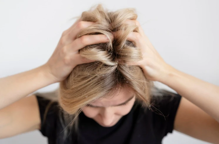 Bitmeyen kepek sorunun altında yatan büyük neden! Banyoda yapılan en büyük hata 7 Ekran goruntusu 2026 01 02 212523