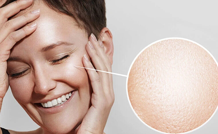 Kimyasal kullanmadan cilt bariyerini yenileyin! Gözenekleri adım adım küçültür 5 Gozenek Bakimi e1631965750405