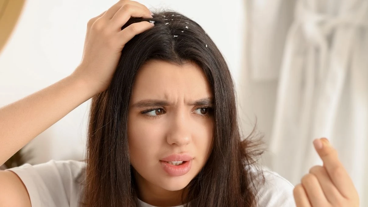 Kepekli saç problemine İbn-i Sina çözümü! Saç derisini temizliyor