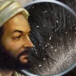 Kepekli saç problemine İbn-i Sina çözümü! Saç derisini temizliyor
