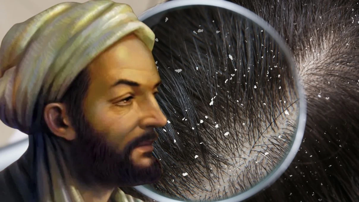 Kepekli saç problemine İbn-i Sina çözümü! Saç derisini temizliyor