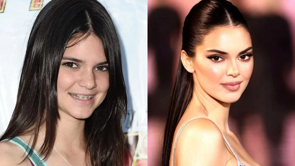 Kendall Jenner’ın şoke eden açıklaması sosyal medyaya damga vurdu! “Hiç estetik yaptırmadım” 8 Kendall Jenner’ın şoke eden açıklaması sosyal medyaya damga vurdu! “Hiç estetik yaptırmadım”