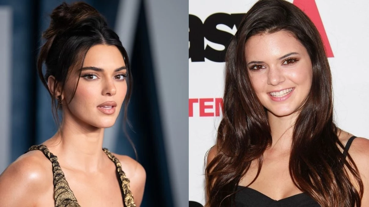Kendall Jenner’ın şoke eden açıklaması sosyal medyaya damga vurdu! “Hiç estetik yaptırmadım”