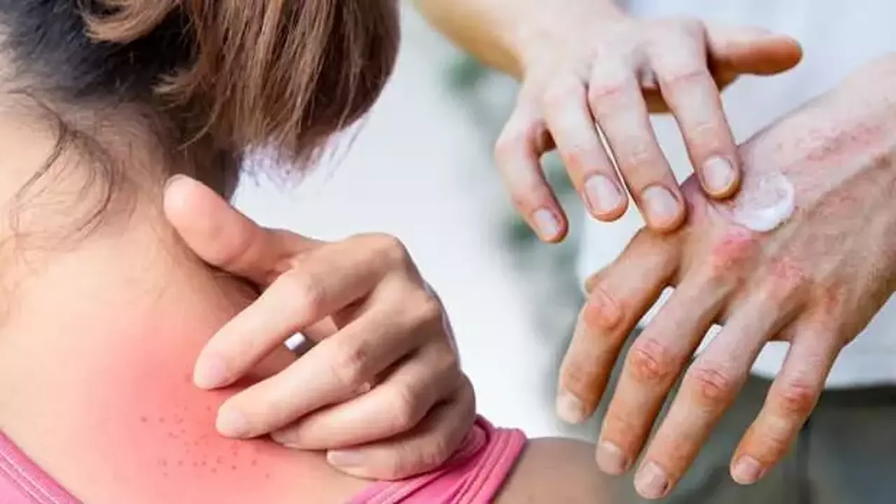 Lr0aP 1645526548 0403