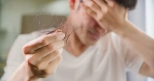 Saç dökülmesinin altındaki en büyük neden! İbn-i Sina yıllar önce söyledi 5 hair loss from stress understanding its impact