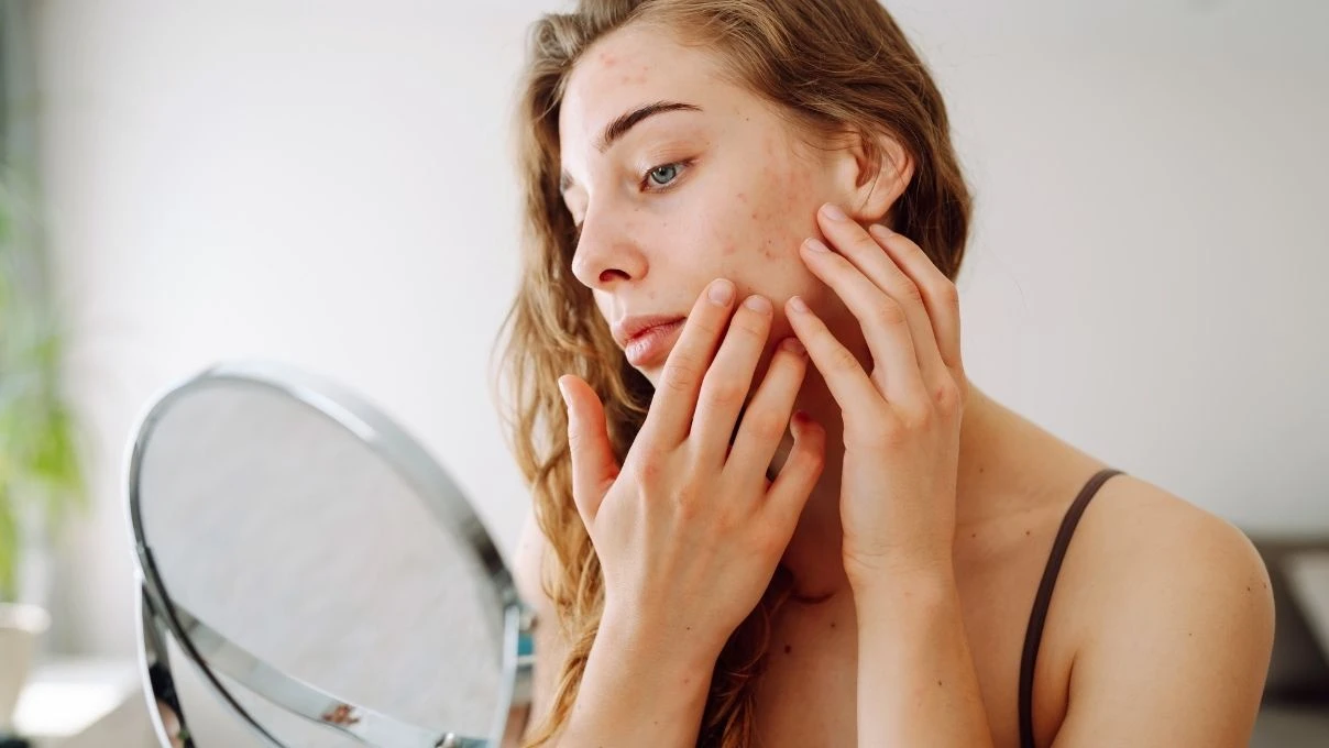 Medikal cilt temizliği nedir, kimlere yapılır? Medikal cilt temizliği öncesi nelere dikkat edilmeli?