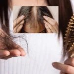saç dökülmesini durduran tarif! Saç dökülmesi neden olur