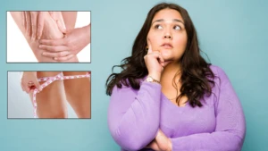 Tek bacakta selülit olur mu? Kadın erkek herkesin kabusu