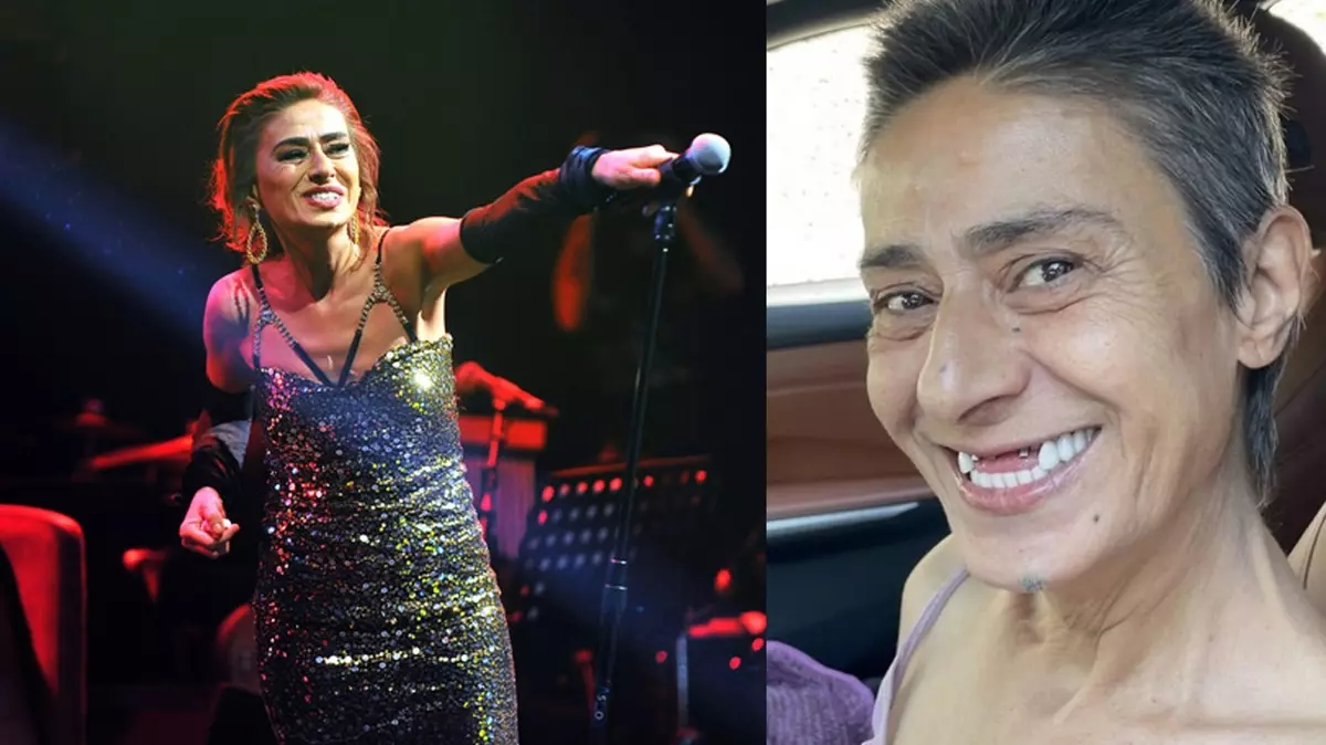 t25 yildiz tilbe yeni disleri 500