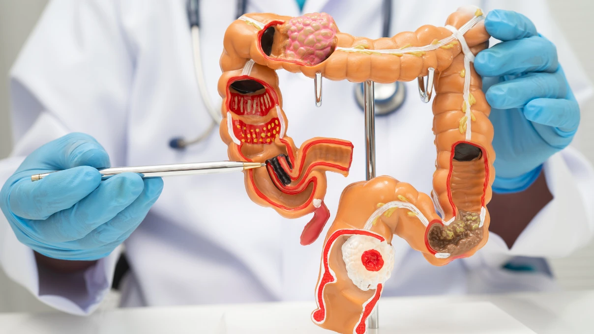 Sindirim sorununa doğal çözüm! Büşra Çalışkan'dan bağırsak temizleyici kür tarifi 5 Asli 2026 02 23T154710.421