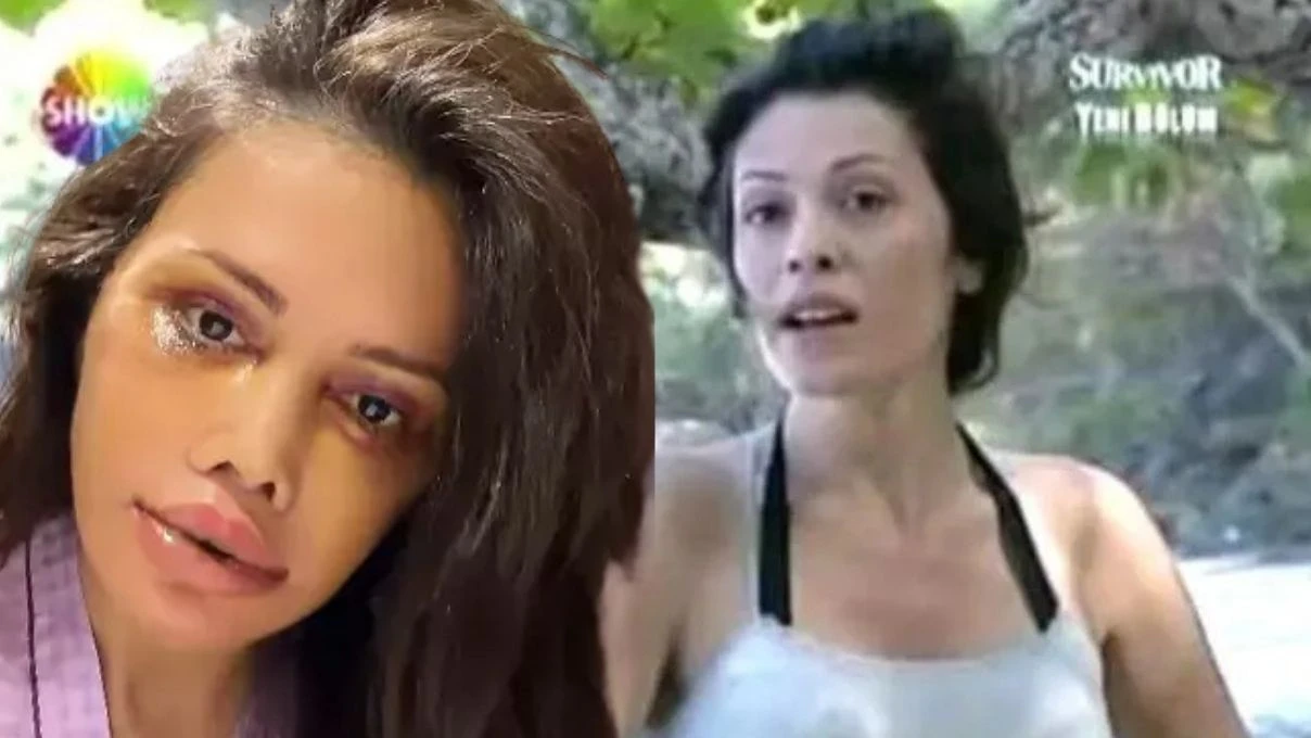 Eski Survivor yarışmacısı Didem Ceran Kore’de yüz nakli oldu! Yeni hali dikkatlerden kaçmadı