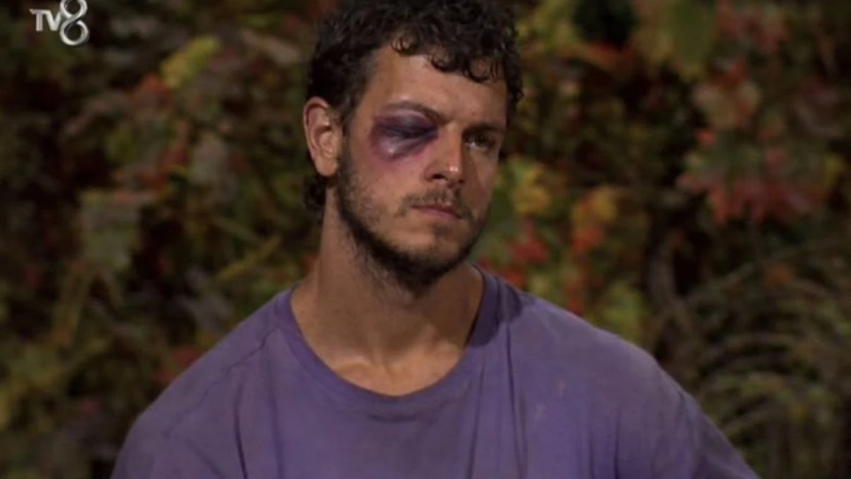 engincanin mor gozu gercek mi