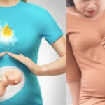 hamilelikte mide yanmasına ne iyi gelir, mide yanması neden olur