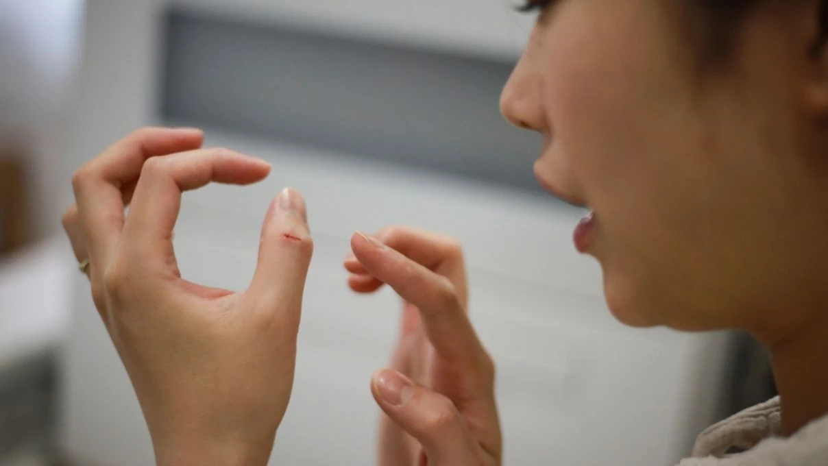 Yara ve kesiklere birebir iyi gelen kadim krem! Asırlık tarif