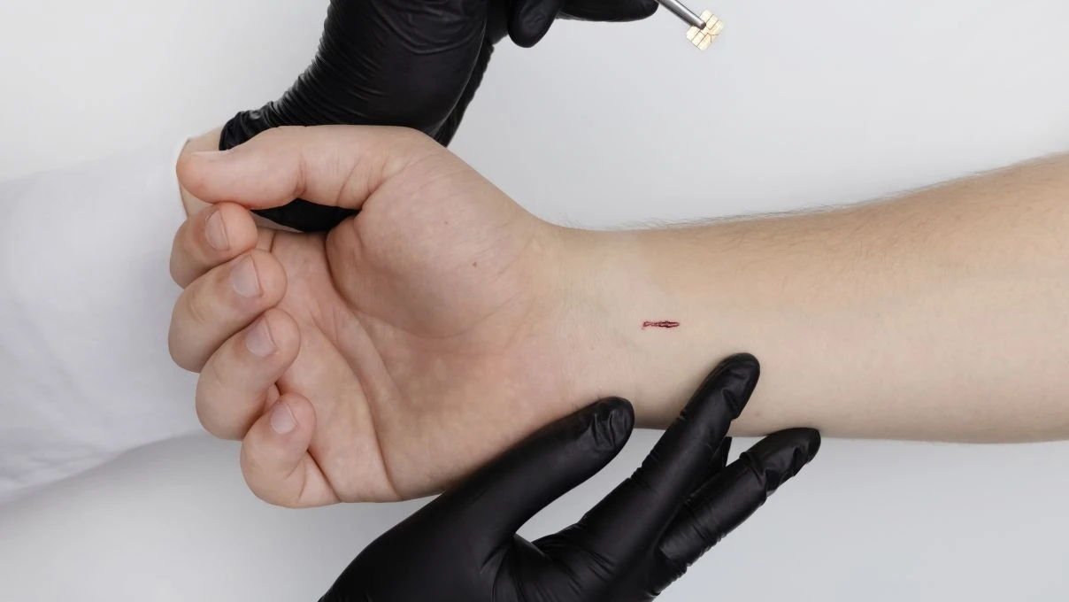 Evde kesik pansumanı nasıl yapılır? Açık yaraya pansuman yaparken nelere dikkat edilmeli?