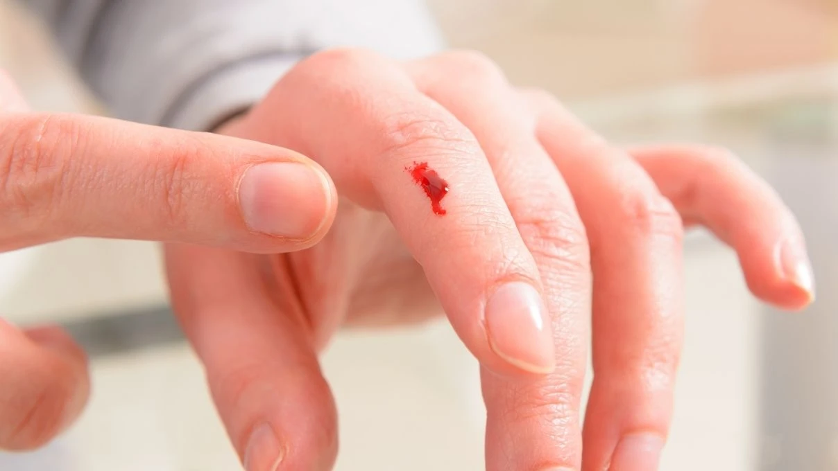 Evde kesik pansumanı nasıl yapılır? Açık yaraya pansuman yaparken nelere dikkat edilmeli?