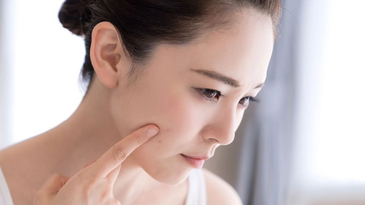 Cildin yeni dostu! Sivilcelerden lekelere her derde deva 