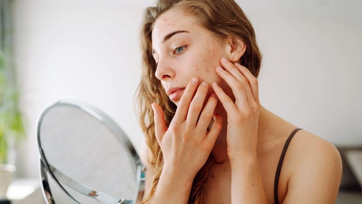 Cildin yeni dostu! Sivilcelerden lekelere her derde deva 