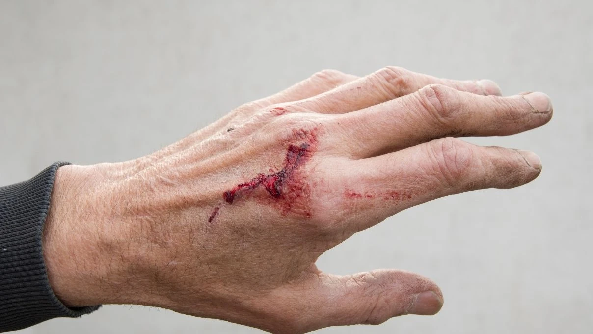 Yara ve kesikleri iyileştiren krem! Kadim tarifiyle