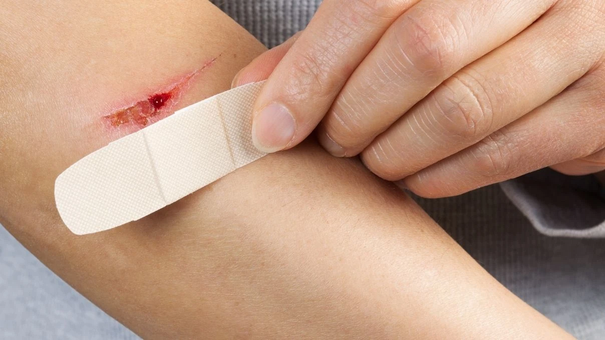 Yara ve kesikleri iyileştiren krem! Kadim tarifiyle