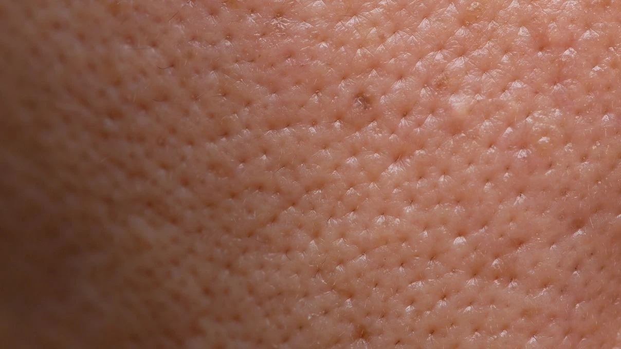 Gözenek küçülten çay! Bu kez sürmüyorsunuz, içiyorsunuz