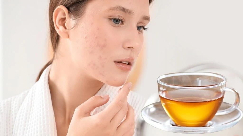 Gözenek küçülten çay! Bu kez sürmüyorsunuz, içiyorsunuz