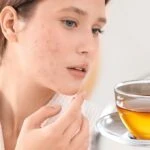 Gözenek küçülten çay! Bu kez sürmüyorsunuz, içiyorsunuz