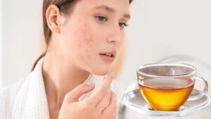 Gözenek küçülten çay!