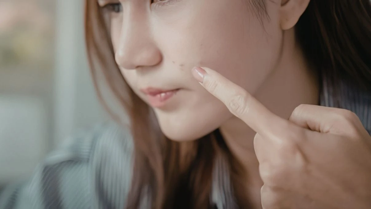 Ciltteki lekelere son! Asırlık cilt tonu eşitleyen maske tarifi