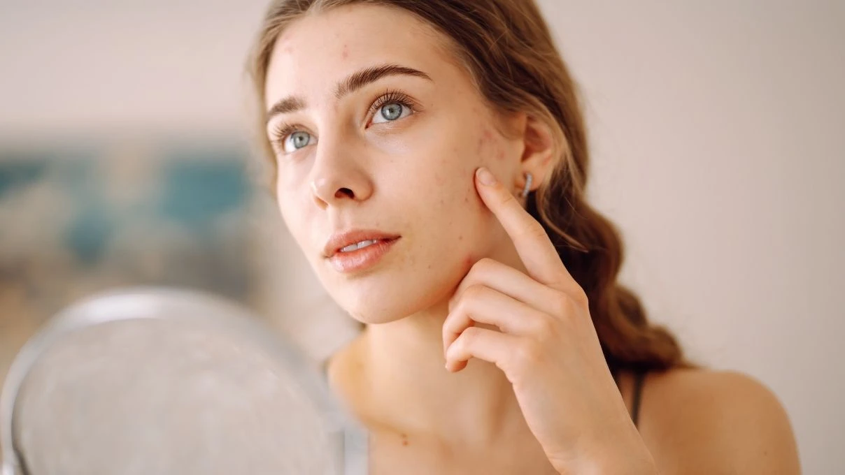 Ciltteki lekelere son! Asırlık cilt tonu eşitleyen maske tarifi