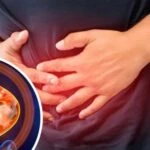 bağırsak paraziti neden olur