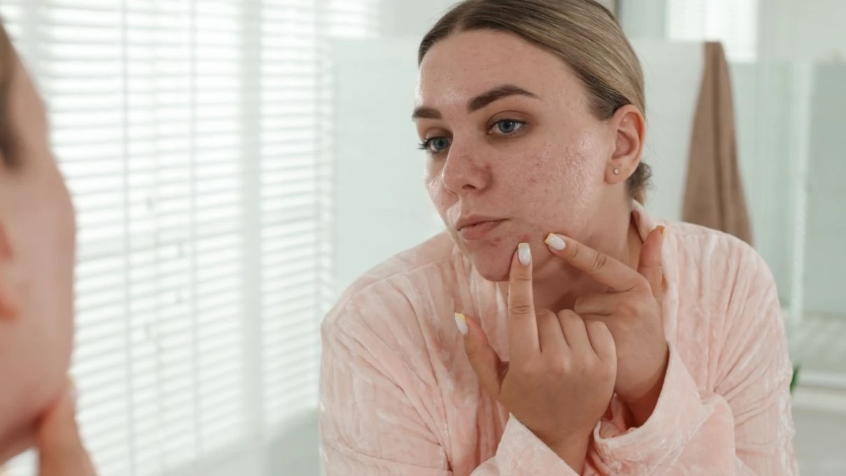 Cilt lekelerini azaltan doğal maske! Evde yapabilirsiniz