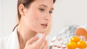 Cilt lekelerini azaltan doğal maske!