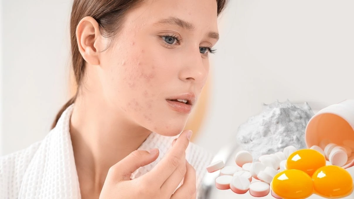 Cilt lekelerini azaltan doğal maske! Evde yapabilirsiniz