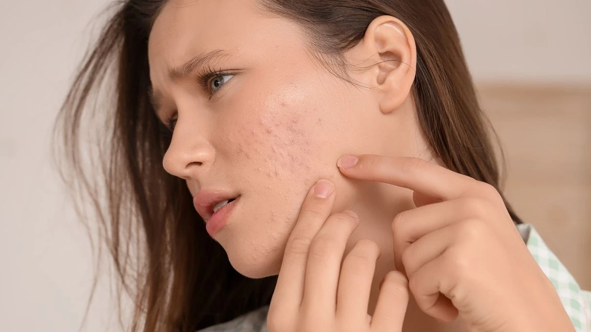 Cilt lekelerini azaltan doğal maske! Evde yapabilirsiniz